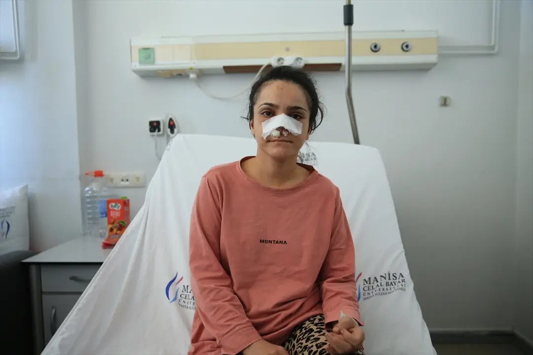 Kadın: Eşim burnumu ısırdı, balkondan atlamayı düşündüm