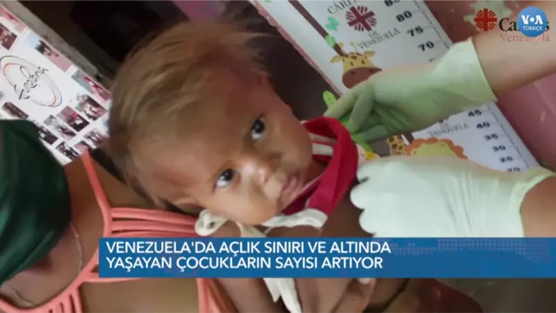 Venezuela'da 1 Milyondan Fazla Çocuğun Gıdaya Erişimi Kısıtlı