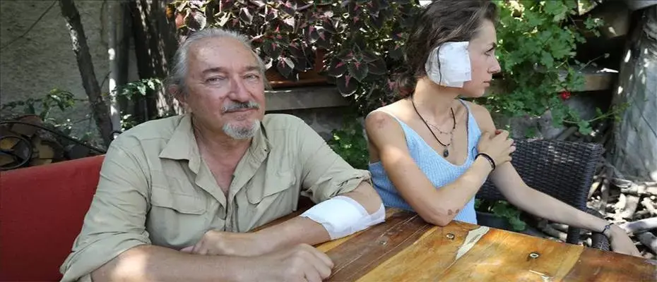 Kapadokya'da sahipsiz köpeklerin saldırdığı 2 İtalyan turist yaralandı